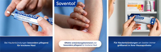 SOVENTOL Κρέμα Hydrocort 0,5%, 30 g