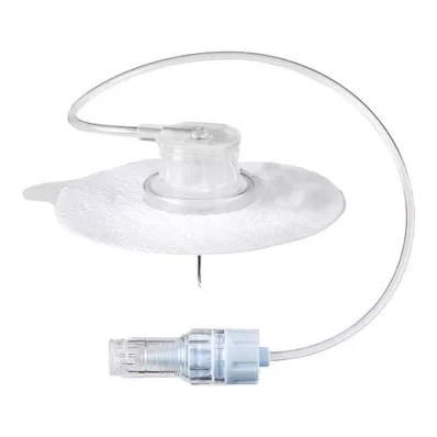 Ambix Intrastick Safe 20 Gx20 mm ανθεκτικό στην πίεση, 1 τεμάχιο